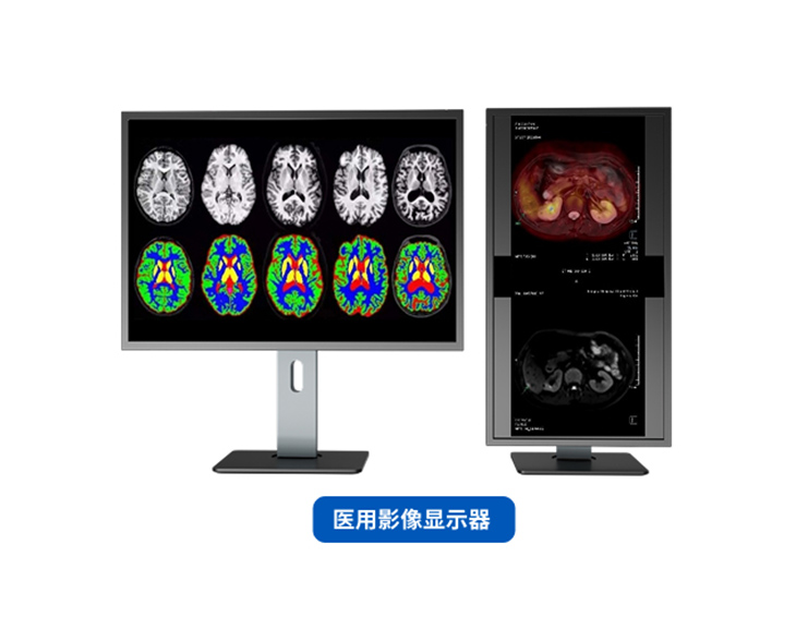 醫(yī)用影像顯示器+數(shù)字人健康助手+個(gè)人健康管理平臺(tái)
